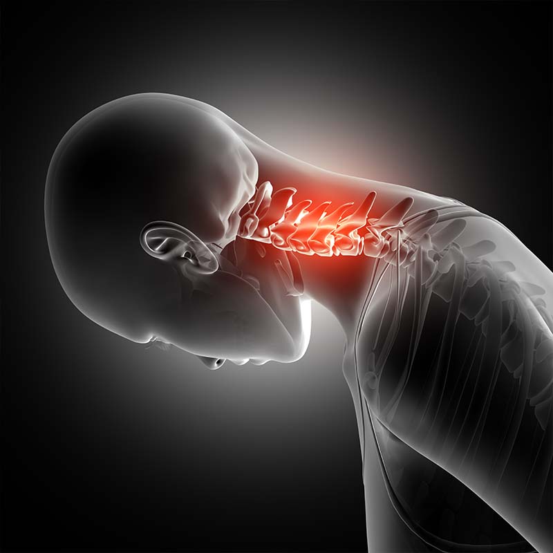 whiplash injury claim